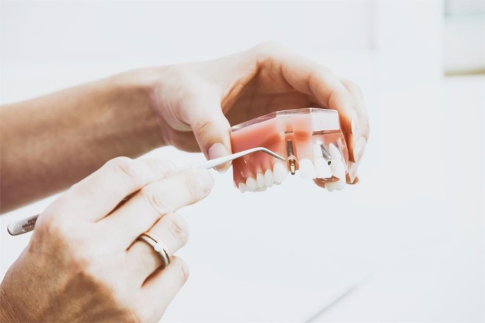 Cirujano maxilofacial para implantes dentales