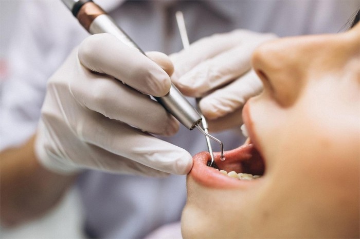 ¿Cuáles son las ventajas de la implantología dental?