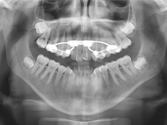 Tratamientos de estética dental: ¡consigue tu mejor sonrisa!